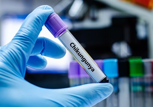 Blood sample tube for chikungunya virus test analysis.
