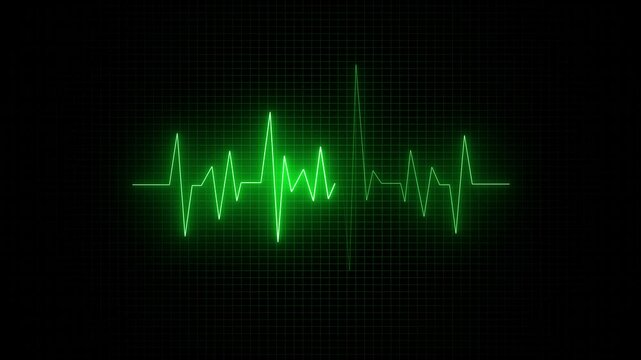 Cardiogram heartbeat pulse rate neon glowing video animation. Emergency ekg monitoring. ECG cardiogram oscilloscope monitor heartbeat line.
