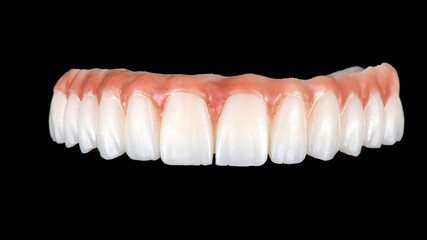zirconium bridge on implants