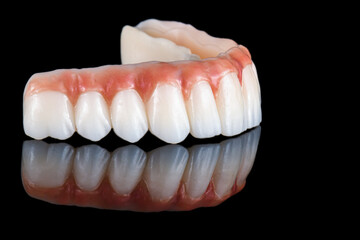 zirconium bridge on implants