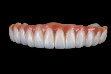 zirconium bridge on implants