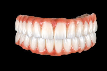 zirconium bridge on implants