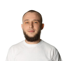 Baldness problem. Portrait of man with receding hairline on white background