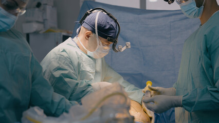 Professional medical team doctors in uniform emergency help surgical operation in clinic hospital...