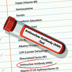 Obraz premium Antinuclear Antibody Test Illustration