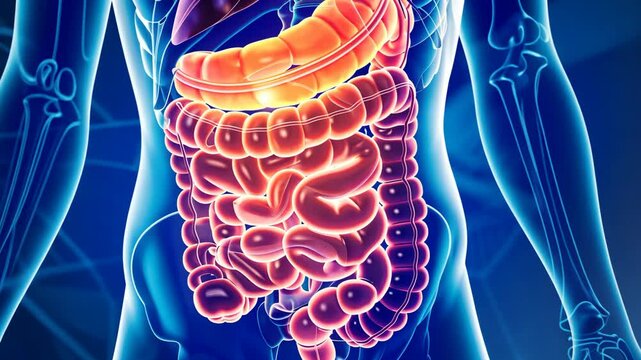 3D Animation of Inflamed Colon Irritable Bowel Syndrome and Colitis