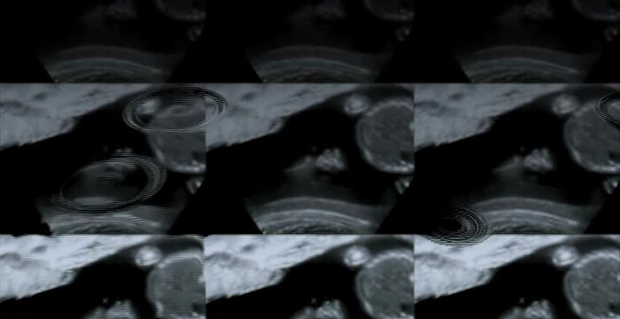 Medical 3D ultrasound image showing a developing fetus at four months of pregnancy