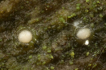 Colloderma oculatum, commonly known as eyeball slime mold, microscope image of early sporangia