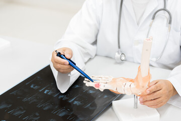 Orthopedist explain to the patient for human foot bone injury treatment program.Doctor showing to...