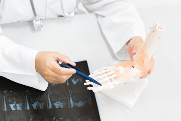 Orthopedist explain to the patient for human foot bone injury treatment program.Doctor showing to...