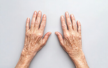 Elderly hands with visible veins and wrinkles on light background