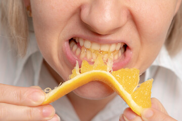 A close-up of a woman biting into a slice of orange, showcasing her teeth and expression.