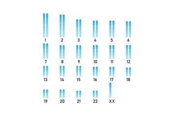 Turner Syndrome Science Design. Vector Illustration.