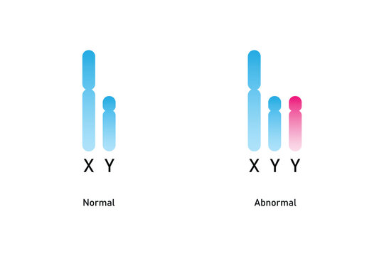 XYY Syndrome Science Design. Vector Illustration.