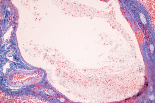 Showing Light micrograph of the Adrenal gland, Spleen human and Other human tissues under the microscope for education in the laboratory.