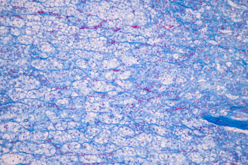 Showing Light micrograph of the Adrenal gland, Spleen human and Other human tissues under the microscope for education in the laboratory.