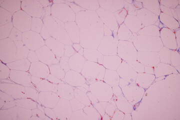 Showing Light micrograph of the Adrenal gland, Spleen human and Other human tissues under the...