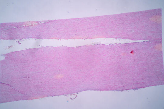 Showing Light micrograph of the Adrenal gland, Spleen human and Other human tissues under the microscope for education in the laboratory.