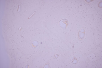 Showing Light micrograph of the Adrenal gland, Spleen human and Other human tissues under the...