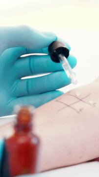Doctor doing skin prick test at his patient