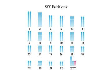 XYY Syndrome Science Design. Vector Illustration.