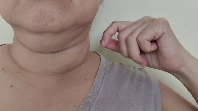 Portrait the fingers holding the flabbiness adipose sagging  skin, large and layer skin, cellulite and loose on the throat, Flabby skin and creases on the neck, health care and beauty concept.