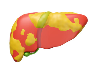 3d fatty liver disease isolated. 3d illustration render