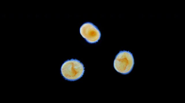 Lecithotrophic larva Bryozoa or Ectoprocta under a microscope. Coronate larva. Sample found in White sea.