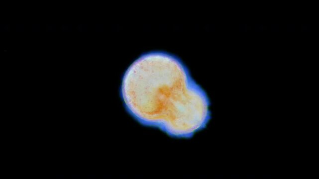 Lecithotrophic larva Bryozoa or Ectoprocta under a microscope. Coronate larva. Sample found in White sea.