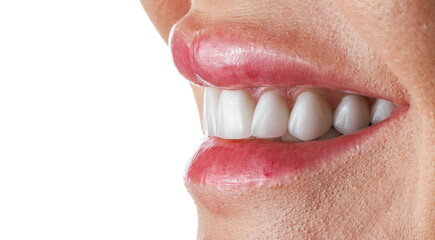 Obraz premium beautiful smile by veneers teeth