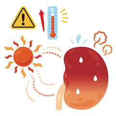 暑さでバテる腎臓のイラスト