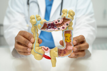 Intestine, appendix and digestive system, doctor holding anatomy model for study diagnosis and...