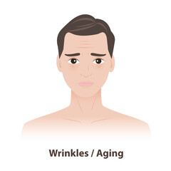 The man with wrinkles and fine lines on face vector illustration isolated on white background. Skin problems in men include aging, particularly around the eyes and forehead. Men skin care concept.