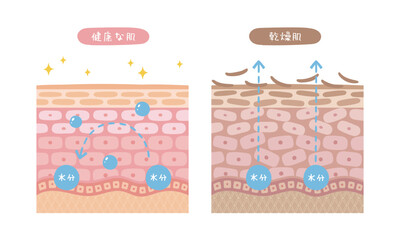 健康な肌と乾燥肌の断面図のイラスト