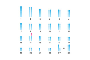 Translocation Down Syndrome Science Design. Vector Illustration.