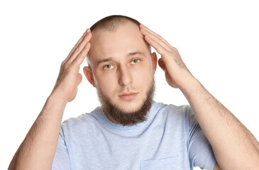 Baldness problem. Man with receding hairline on white background