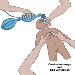 Vector Cardiac massage in babies.