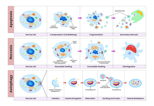 Apoptosis, necrosis and autophagy comparison process diagram infographic, apoptosis versus necrosis difference. Biology education poster.