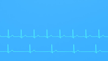 Comparison of ECG of normal heart rhythm and bradycardia.