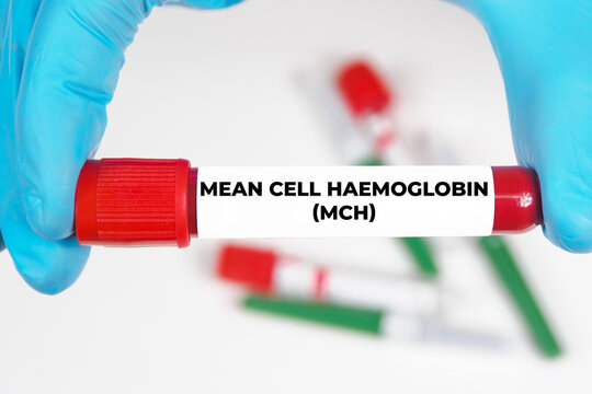 Mean cell haemoglobin (MCH) medical analysis value test tube background