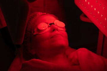Woman receiving red light therapy treatment for skin rejuvenation