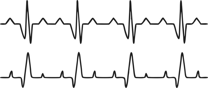Heartbeat line set. EKG. Vector