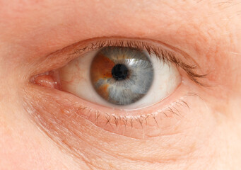 A close up of a person's eye with a brown and blue iris