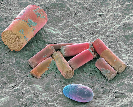 Soil diatoms, SEM