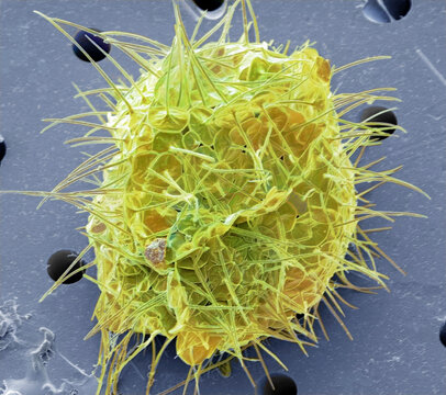 Acanthocystis, SEM