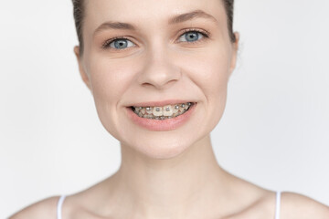Obraz premium beautiful young woman with metal braces, non-ligature, smiling, close-up portrait on a white background, free space