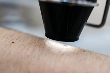 A dermatologist examines and analyzes the skin of a young patient in a modern clinic using advanced equipment. Concept skin research, diagnosis of oncological skin diseases.