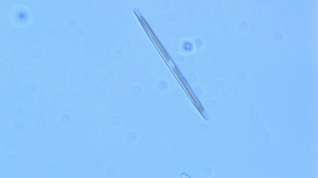 Freshwater diatom glides under microscope - 400X