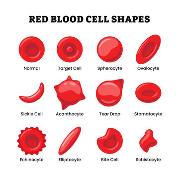 Types of Red Blood Cell Shapes or erythrocytes, morphology normal, target cell, spherocyte, ovalocyte, sickle cell, acanthocyte, tear drop, stomatocyte, echinocyte, elliptocyte, bite cell, schistocyte