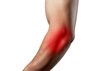 Inflamed elbow (Turns slightly red). isolated on transparent or white background